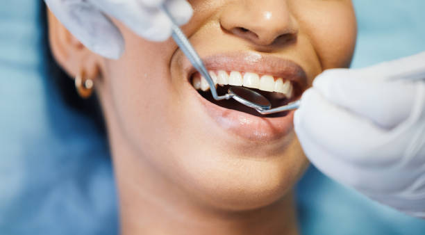 Best Knocked-Out Tooth Emergency  in De Leon Springs, FL